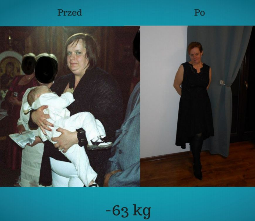 Dieta od lata, Zdrowie na lata! Metamorfoza pani Agnieszki w Centrum Dietetycznym Projekt Zdrowie w Sanoku